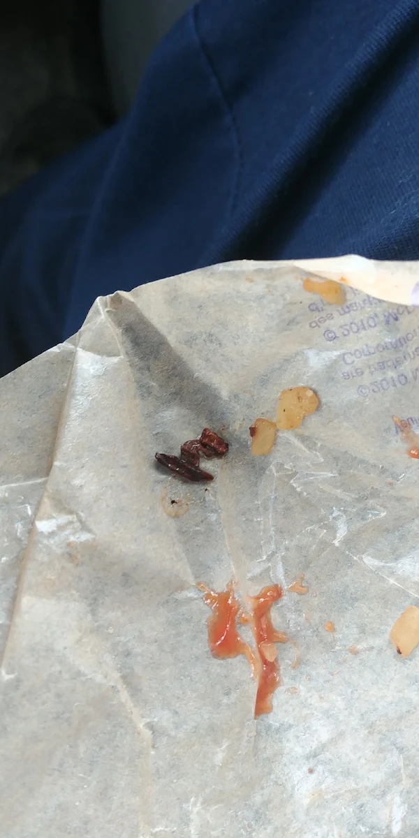 Garbage That Came on the Burger
