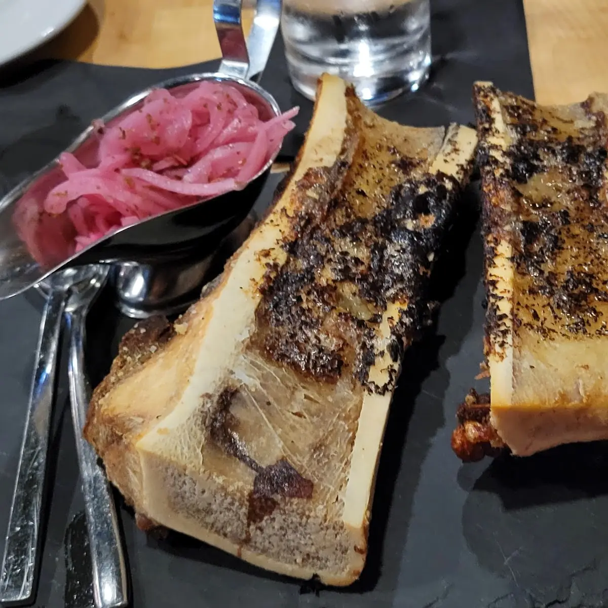 Bone Marrow
