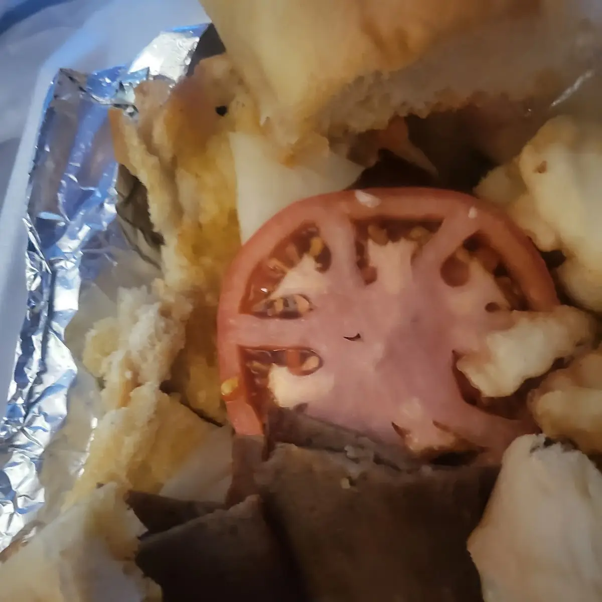 Gyro