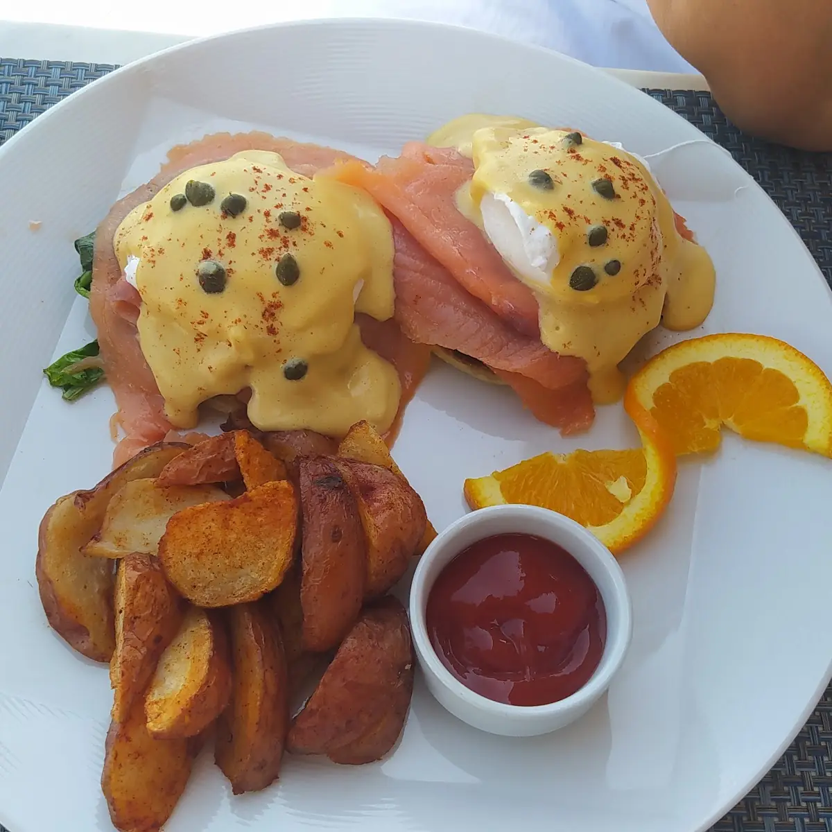 Eggs Benedict