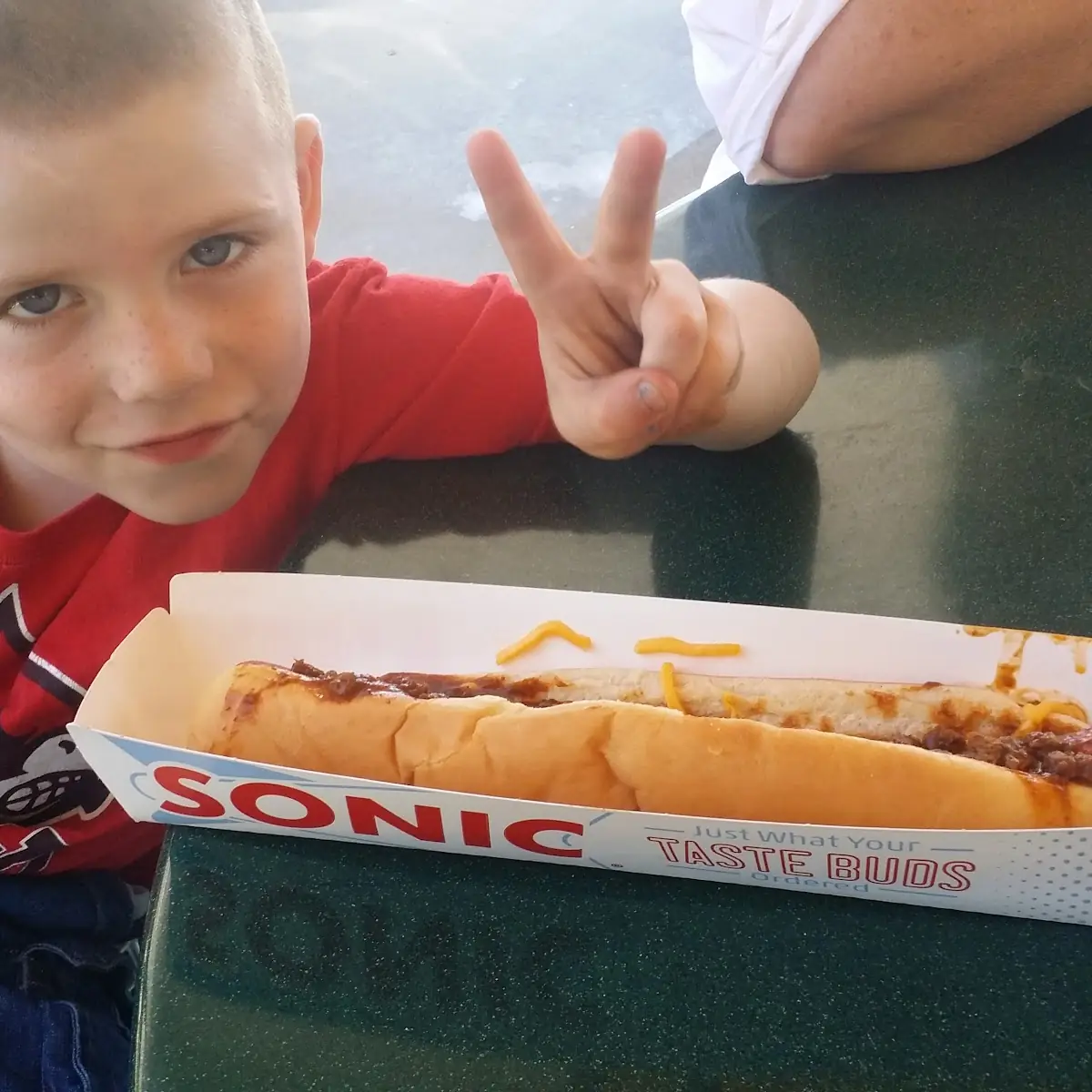 Hot Dog