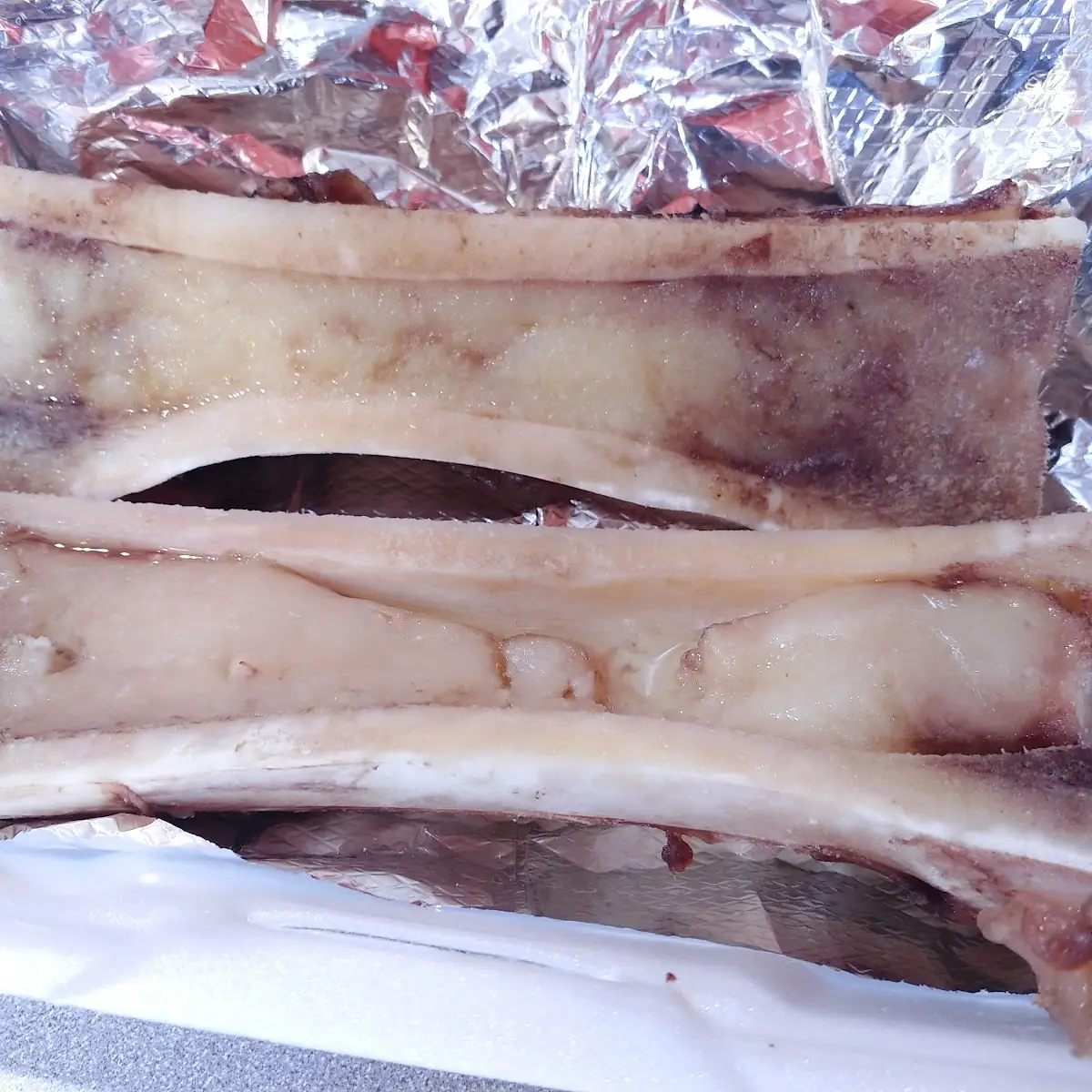 Bone Marrow